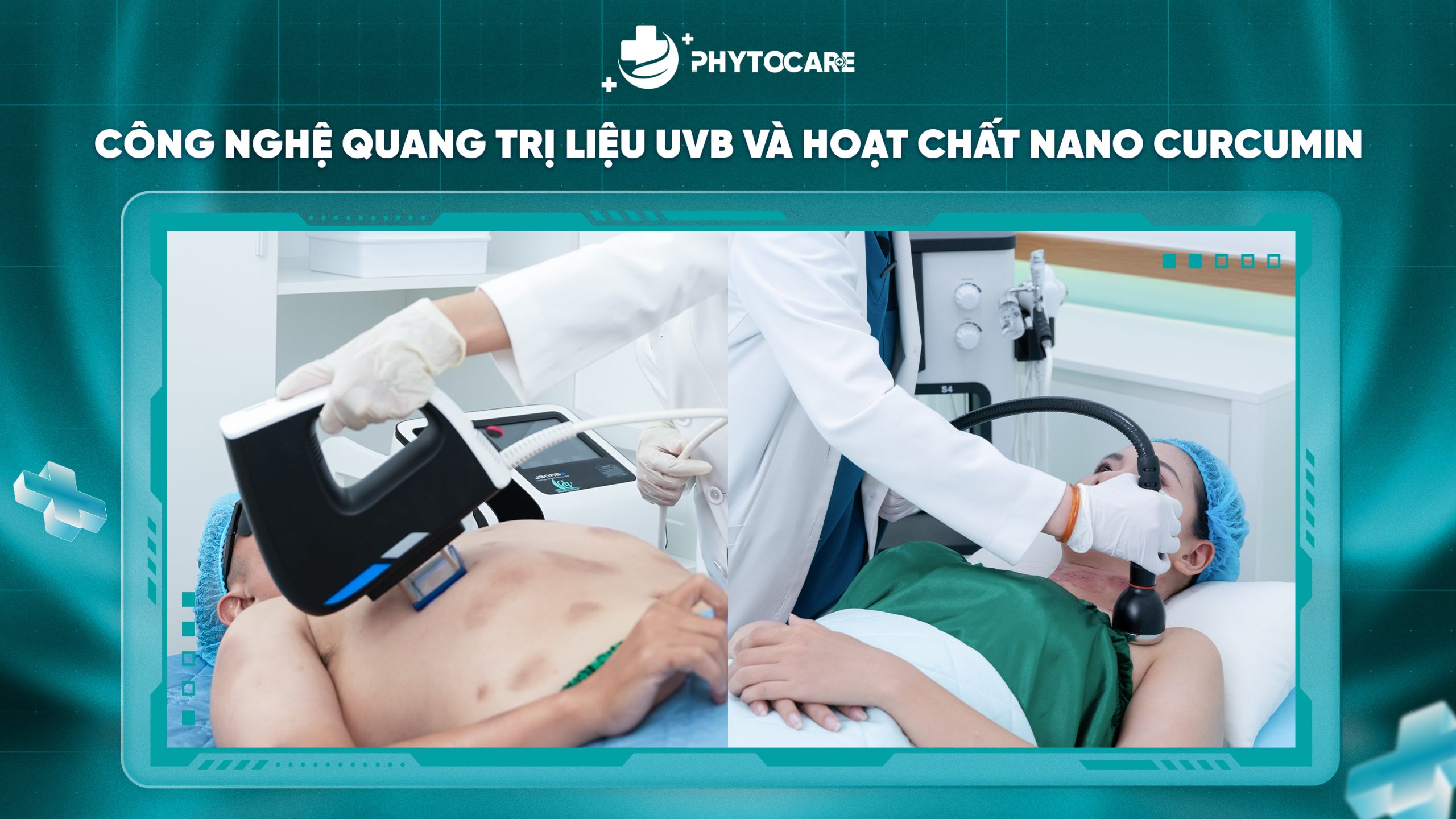 Công nghệ quang trị liệu UVB và Nano Curcumin