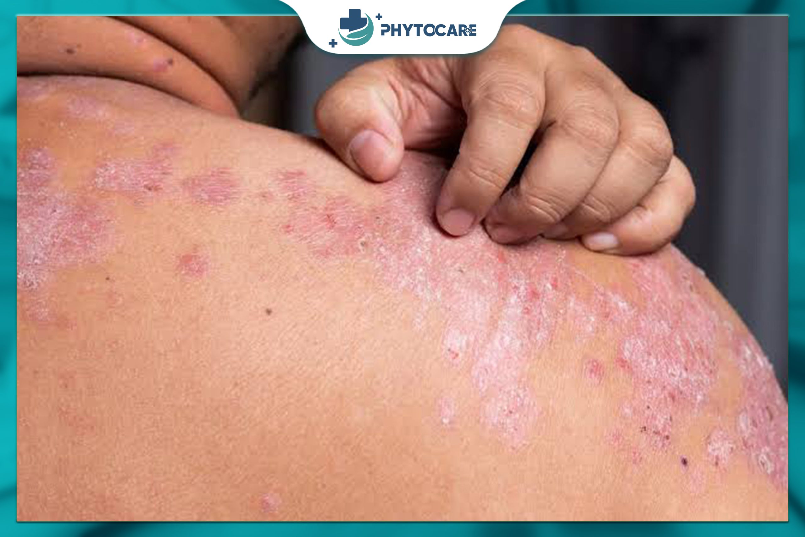 Giai đoạn nhũ nhi (trẻ dưới 2 tuổi)