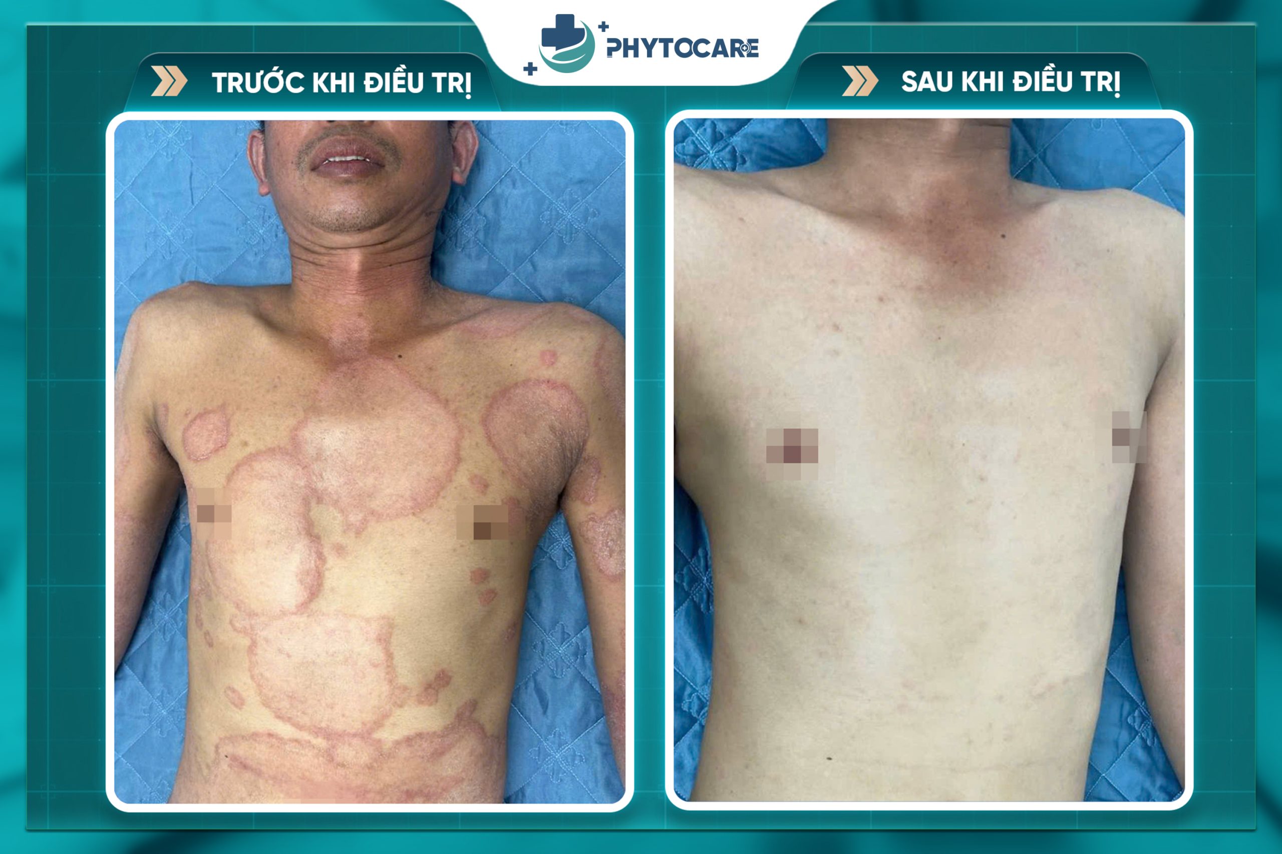 Hiệu quả điều trị 1
