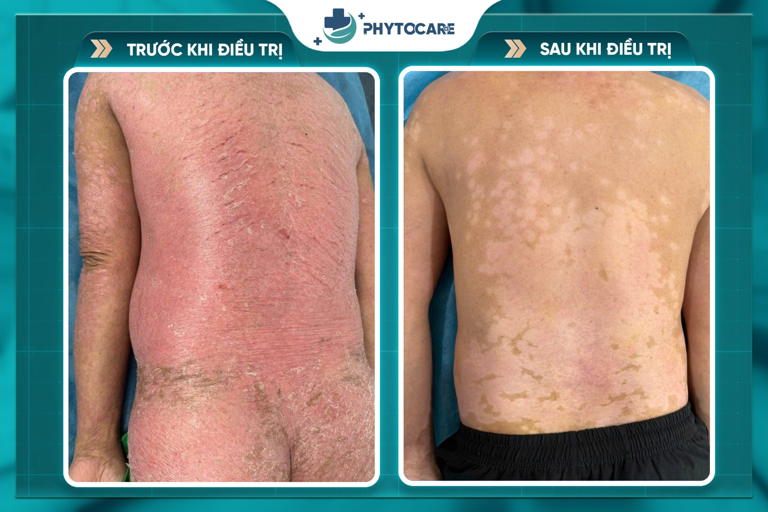 Hiệu quả điều trị 3