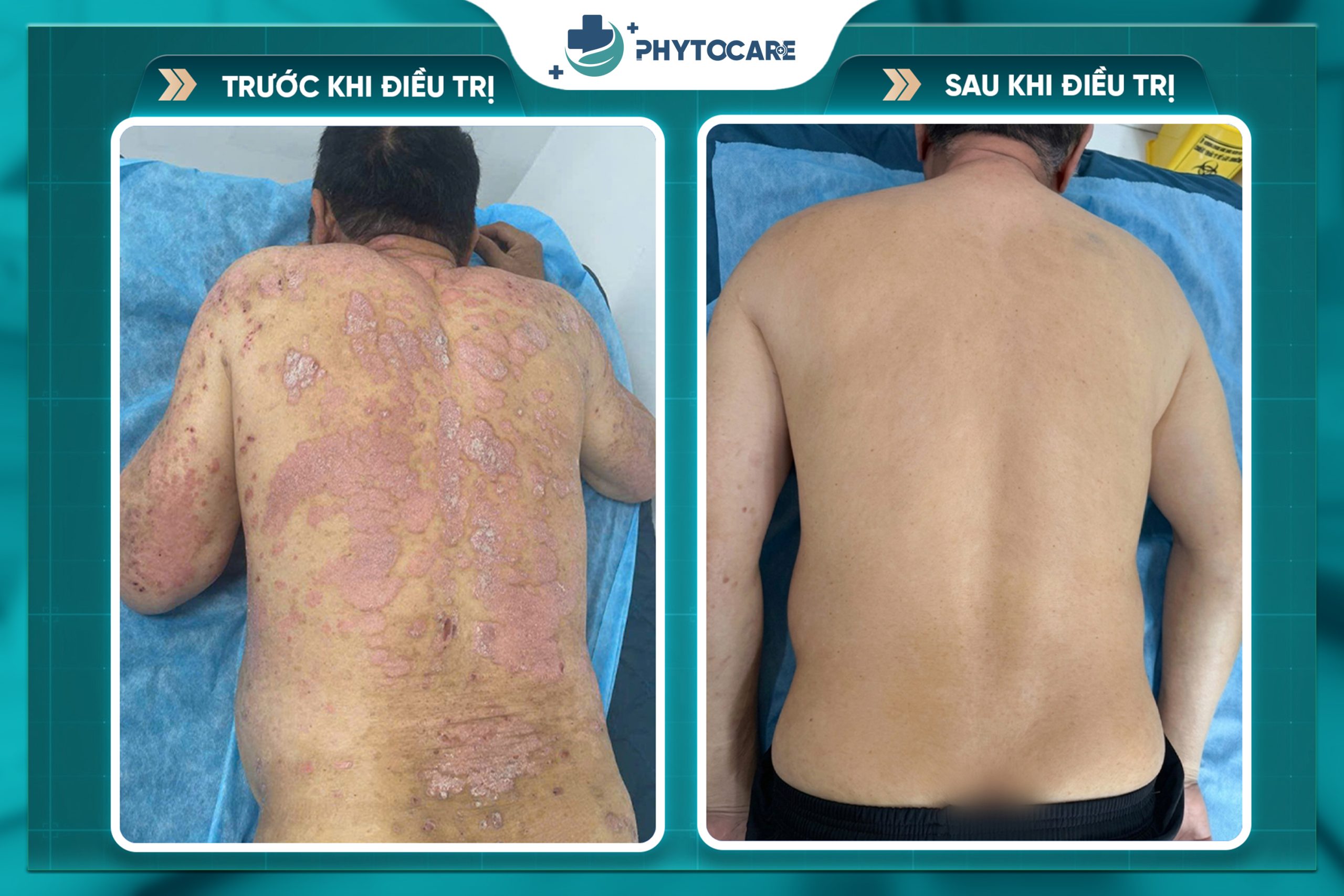 Hiệu quả trước sau điều trị 3